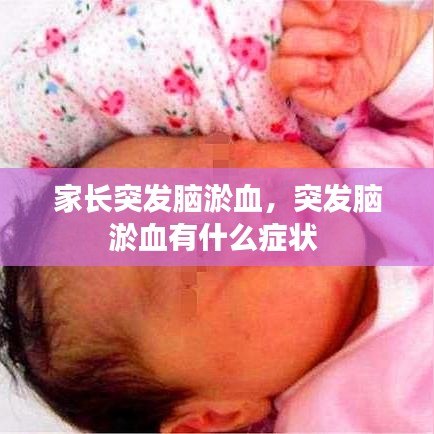 家长突发脑淤血，突发脑淤血有什么症状 
