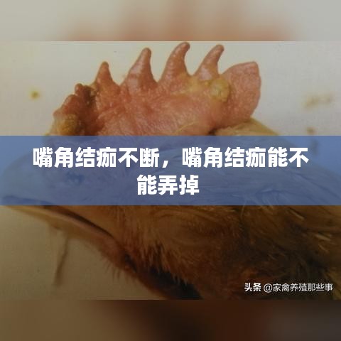 嘴角结痂不断，嘴角结痂能不能弄掉 