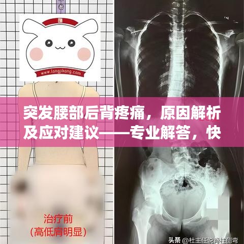 突发腰部后背疼痛，原因解析及应对建议——专业解答，快速缓解病痛